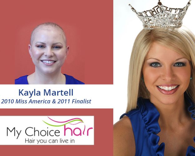 My Choice Hair Hair Replacement for Women Kayla 3