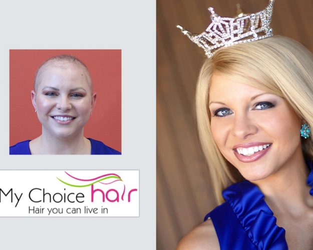 My Choice Hair Hair Replacement for Women Kayla 2